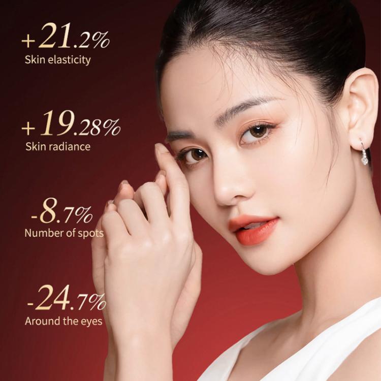 L3007 Frequency Conversion Microcurrent Photon Skin Rejuvenation RF Beauty Instrument, L3007