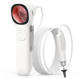 TESLONG SA160 1.45 Inch HD Screen Handheld Smart Visual Otoscope, SA160