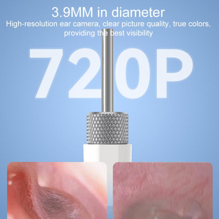 TESLONG SA160 1.45 Inch HD Screen Handheld Smart Visual Otoscope, SA160