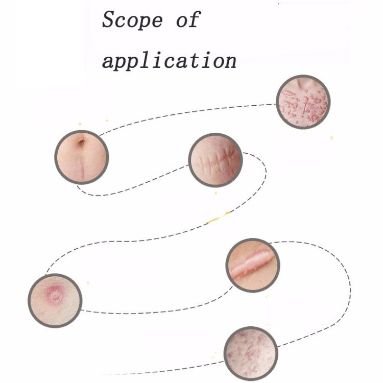 Organic silicone Gel Scar Therapy Patch be Washed and Reused