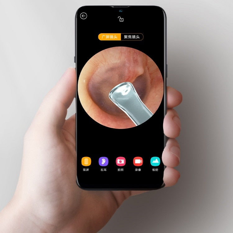 Bebird R1 High-Definition Endoscope Luminous Visual Ear Picking Tool, R1-Classic Black, R1-Moon White