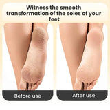 Electric Foot File For Home Use Automatic Callus Remover And Foot Care Tool