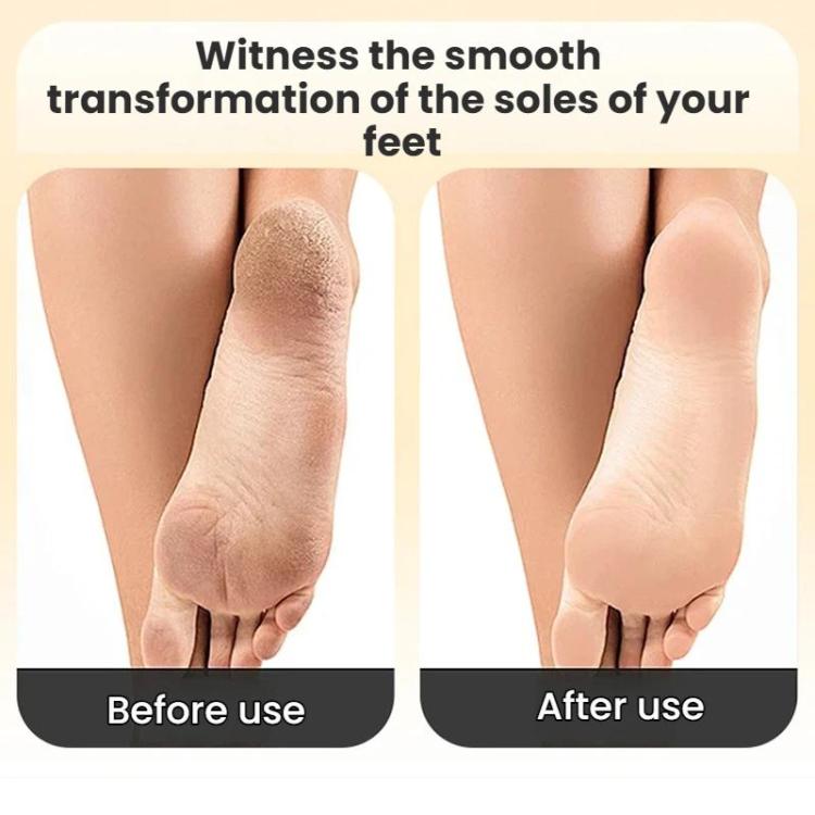 Electric Foot File For Home Use Automatic Callus Remover And Foot Care Tool